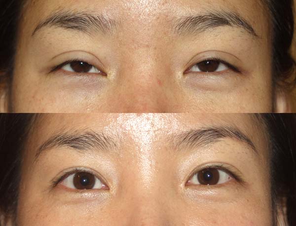 canmake double eyelid
