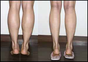 Операция на мышцах ног